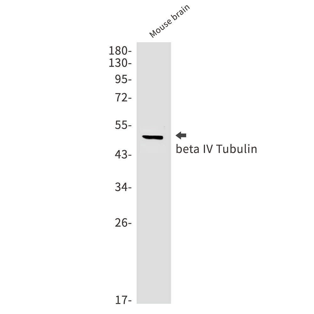 beta IV Tubulin Rabbit Monoclonal Antibody