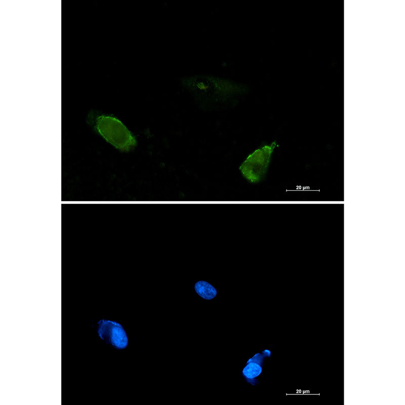 BIN1 Rabbit Monoclonal Antibody