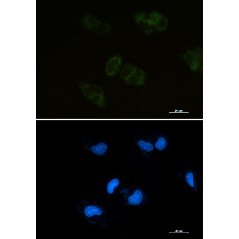 BMP4 Rabbit Monoclonal Antibody