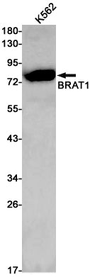 BRAT1 Rabbit Monoclonal Antibody