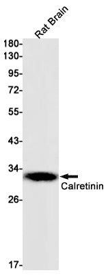 Calretinin Rabbit Monoclonal Antibody