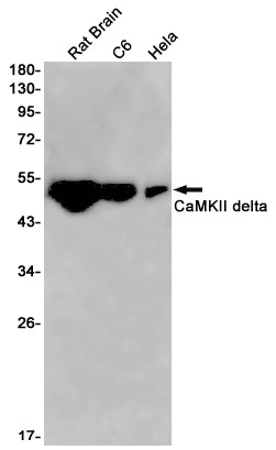 CaMKII delta Rabbit Monoclonal Antibody