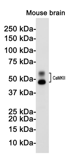 CaMKII beta Rabbit Monoclonal Antibody