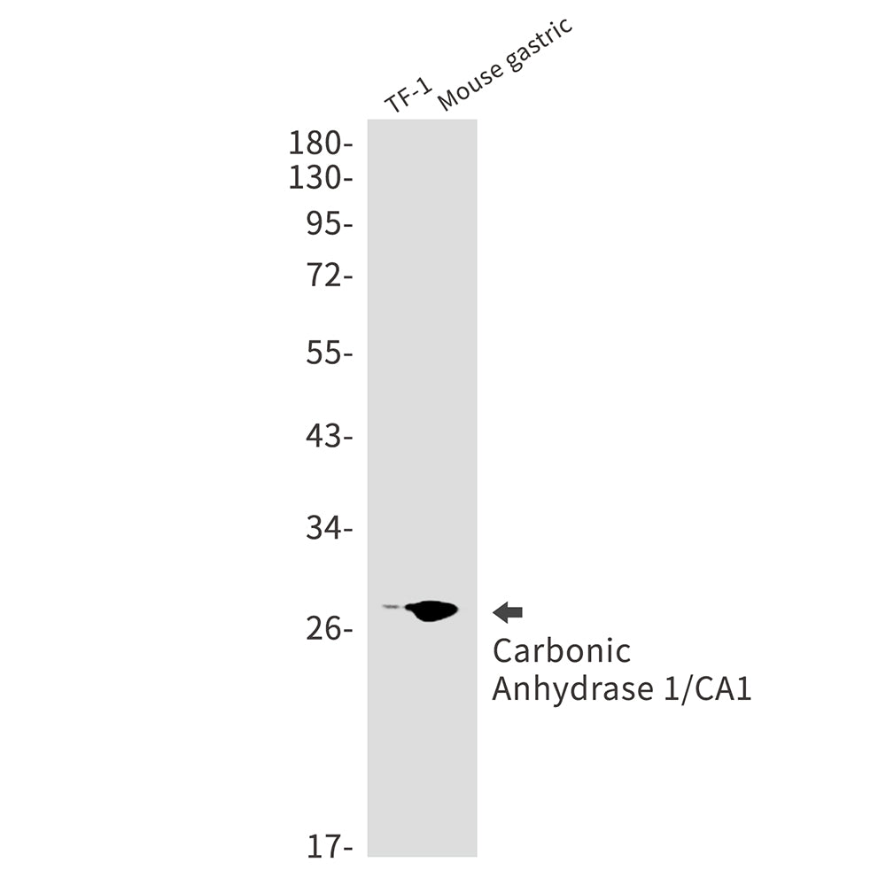 Carbonic Anhydrase 1 Rabbit Monoclonal Antibody