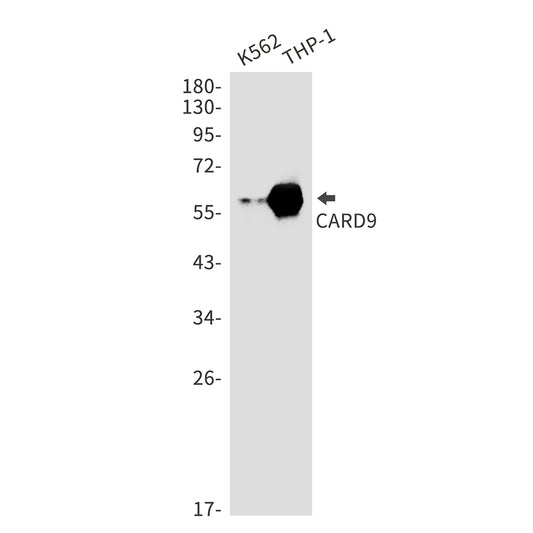 CARD9 Rabbit Monoclonal Antibody