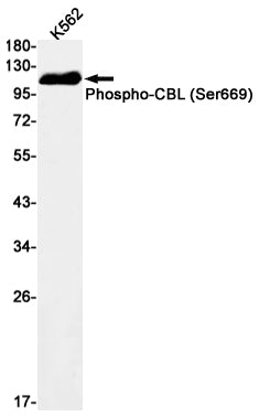 Phospho-CBL (Ser669) Rabbit Monoclonal Antibody