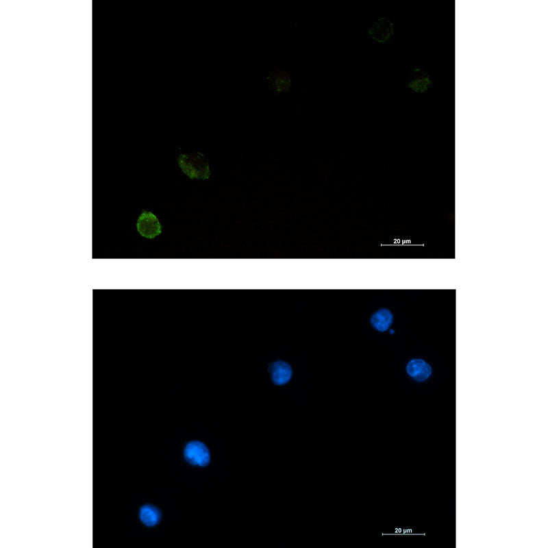 CBL Rabbit Monoclonal Antibody