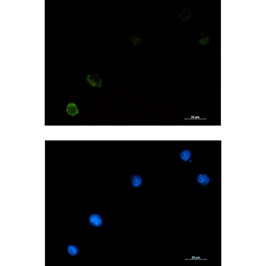 CBL Rabbit Monoclonal Antibody