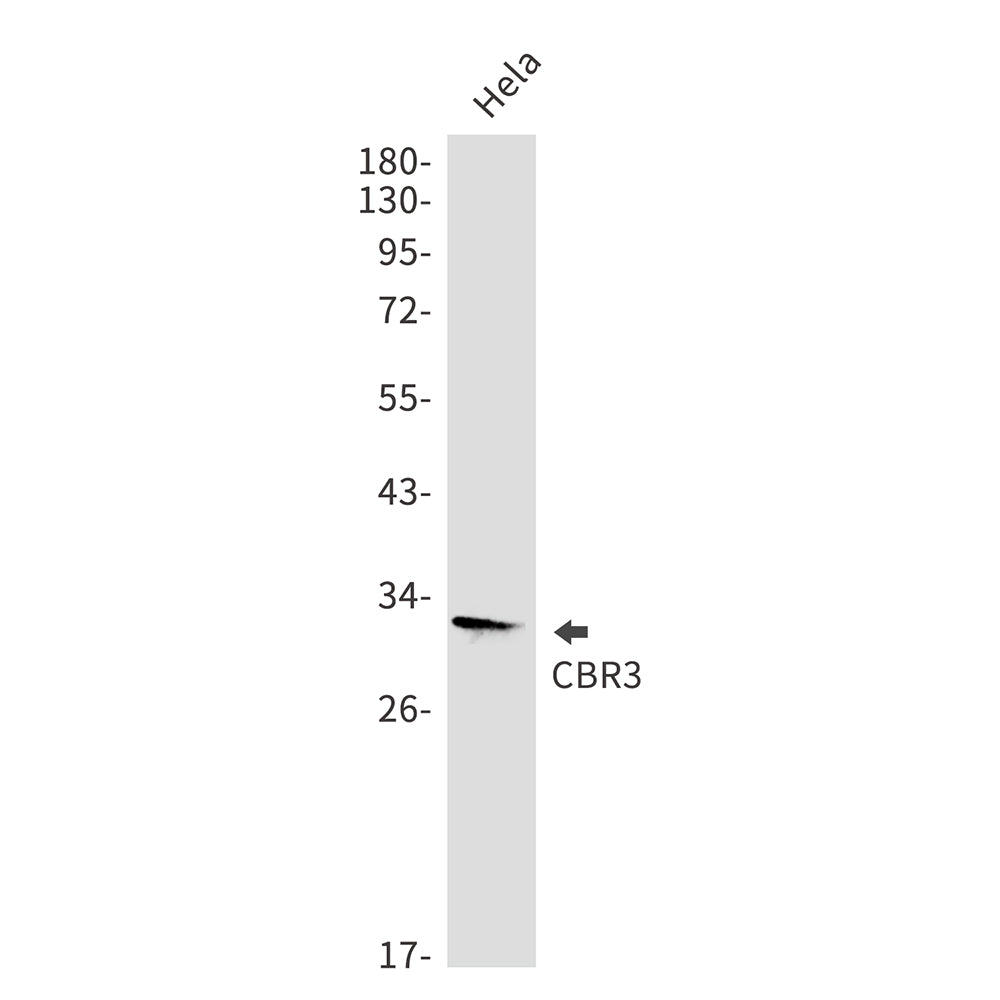 CBR3 Rabbit Monoclonal Antibody