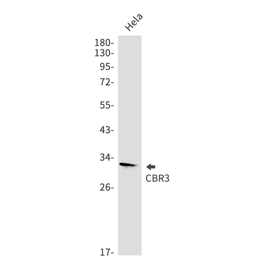 CBR3 Rabbit Monoclonal Antibody