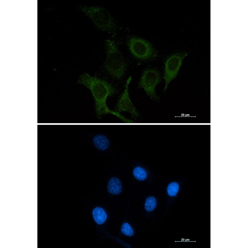 CD166 Rabbit Monoclonal Antibody