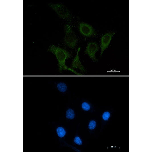 CD166 Rabbit Monoclonal Antibody