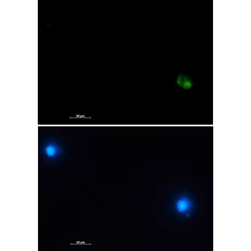 CD22 Rabbit Monoclonal Antibody