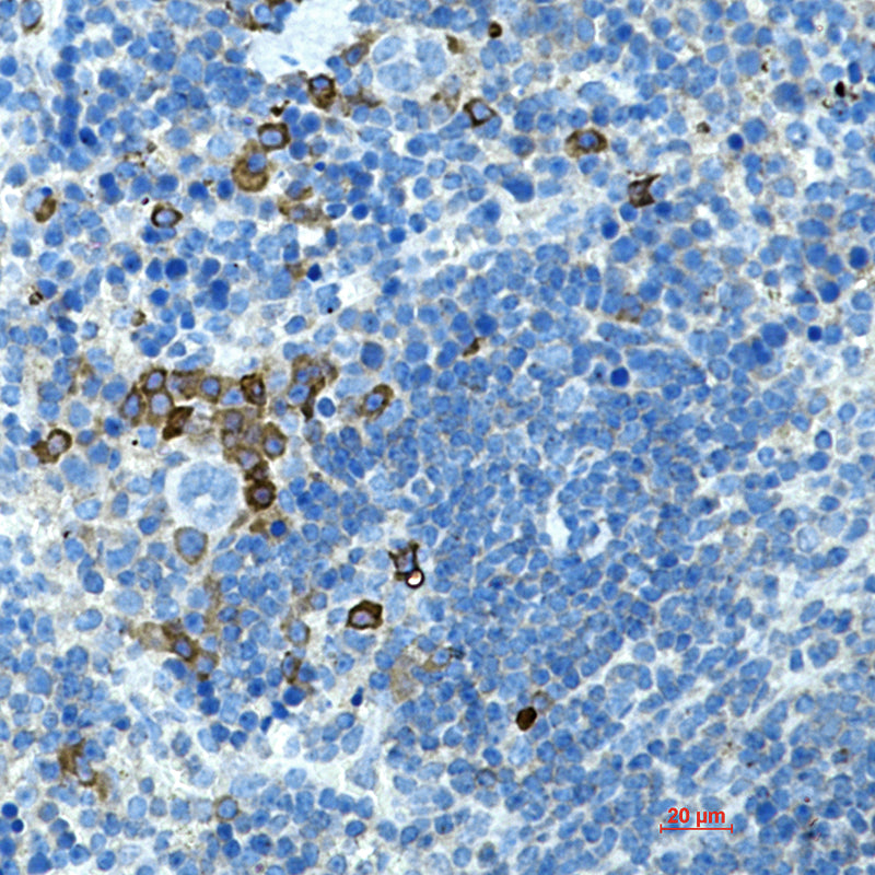CD272 Rabbit Monoclonal Antibody