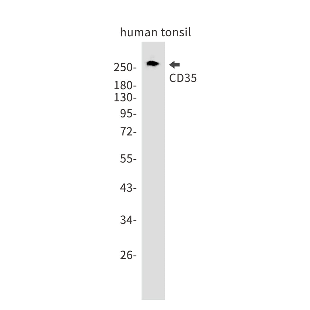 CD35 Rabbit Monoclonal Antibody