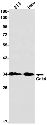 CDK4 Rabbit Monoclonal Antibody
