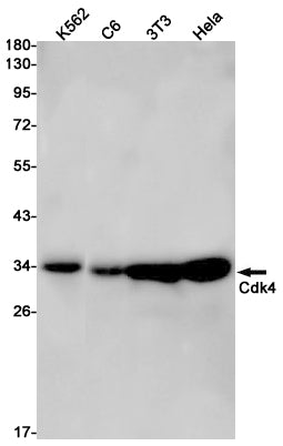 CDK4 Rabbit Monoclonal Antibody