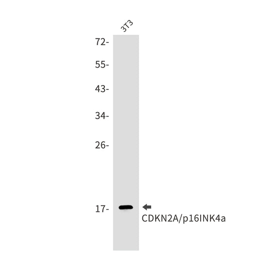 CDKN2A/p16INK4a Rabbit Monoclonal Antibody