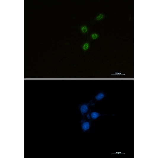 Chk2 Rabbit Monoclonal Antibody