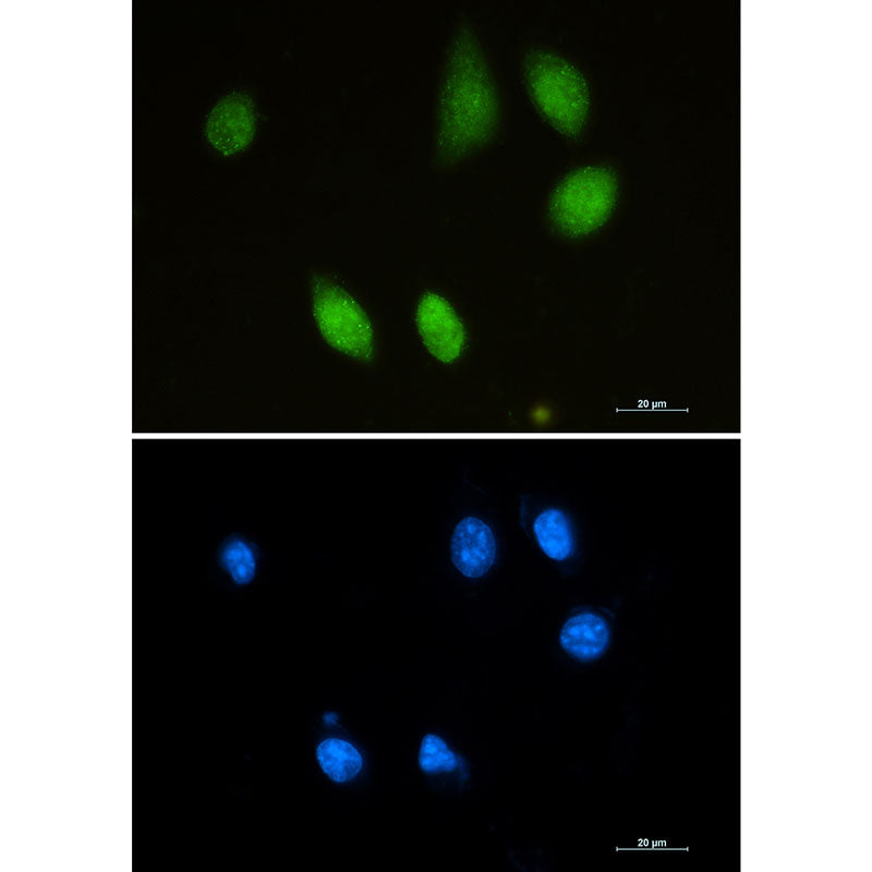 Choline Acetyltransferase Rabbit Monoclonal Antibody