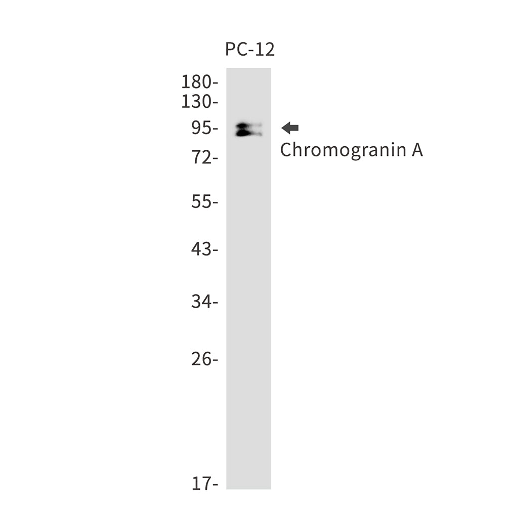 Chromogranin A Rabbit Monoclonal Antibody