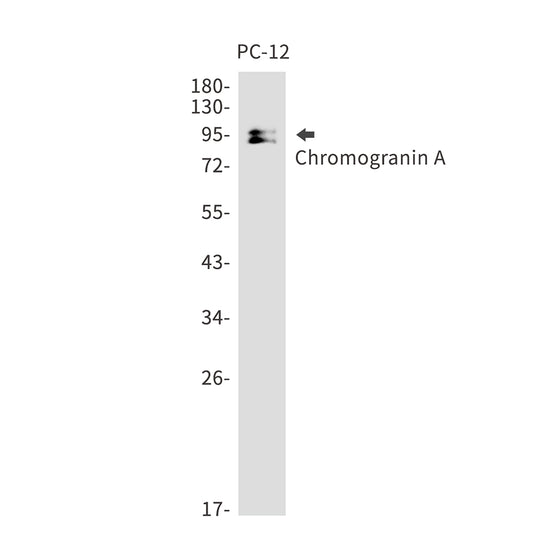 Chromogranin A Rabbit Monoclonal Antibody
