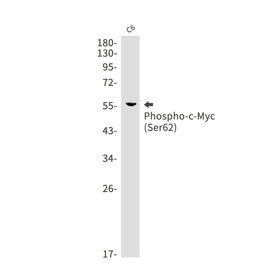 Phospho-c-Myc (Ser62) Rabbit Monoclonal Antibody