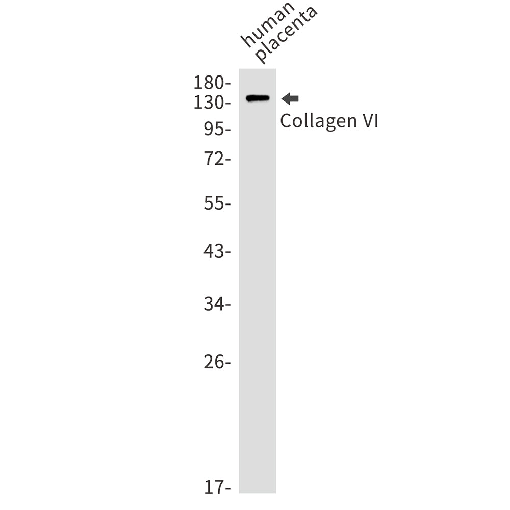 Collagen VI alpha 1 Rabbit Monoclonal Antibody