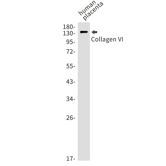 Collagen VI alpha 1 Rabbit Monoclonal Antibody