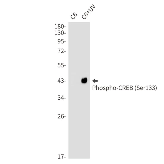 Phospho-CREB (Ser133) Rabbit Monoclonal Antibody