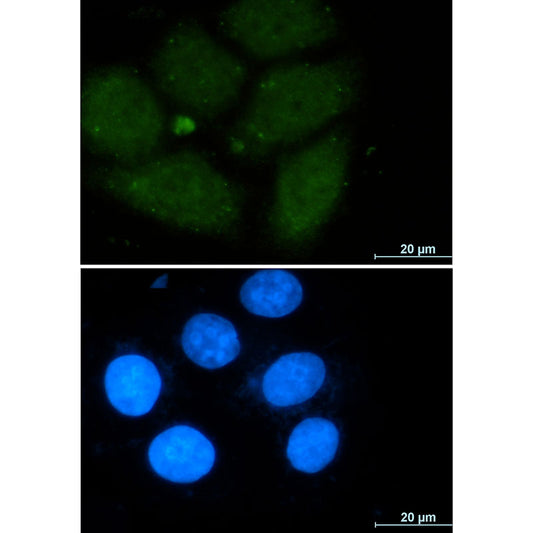 CRM1 Rabbit Monoclonal Antibody