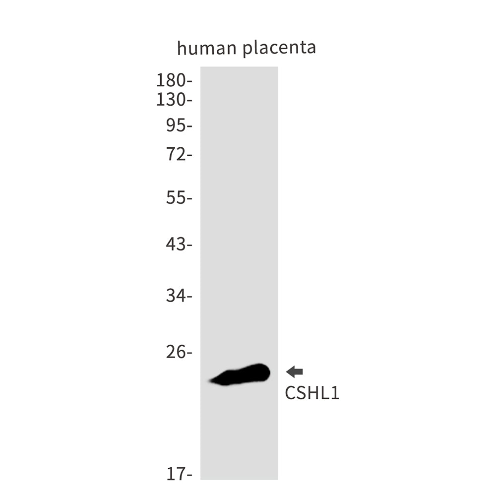 CSHL1 Rabbit Monoclonal Antibody