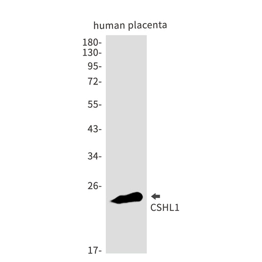 CSHL1 Rabbit Monoclonal Antibody