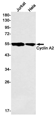 Cyclin A2 Rabbit Monoclonal Antibody