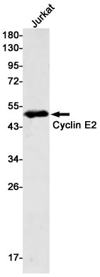Cyclin E2 Rabbit Monoclonal Antibody