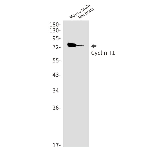 Cyclin T1 Rabbit Monoclonal Antibody