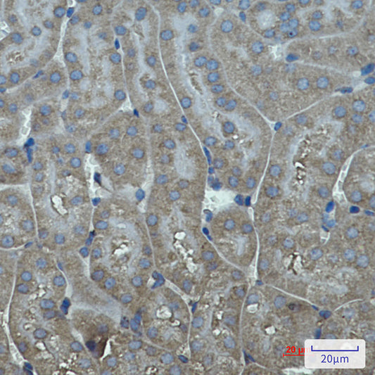 Cytochrome P450 17A1 Rabbit Monoclonal Antibody