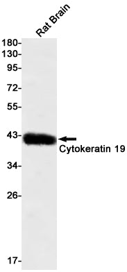 Cytokeratin 19 Rabbit Monoclonal Antibody