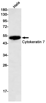 Cytokeratin 7 Rabbit Monoclonal Antibody