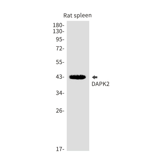 DAPK2 Rabbit Monoclonal Antibody