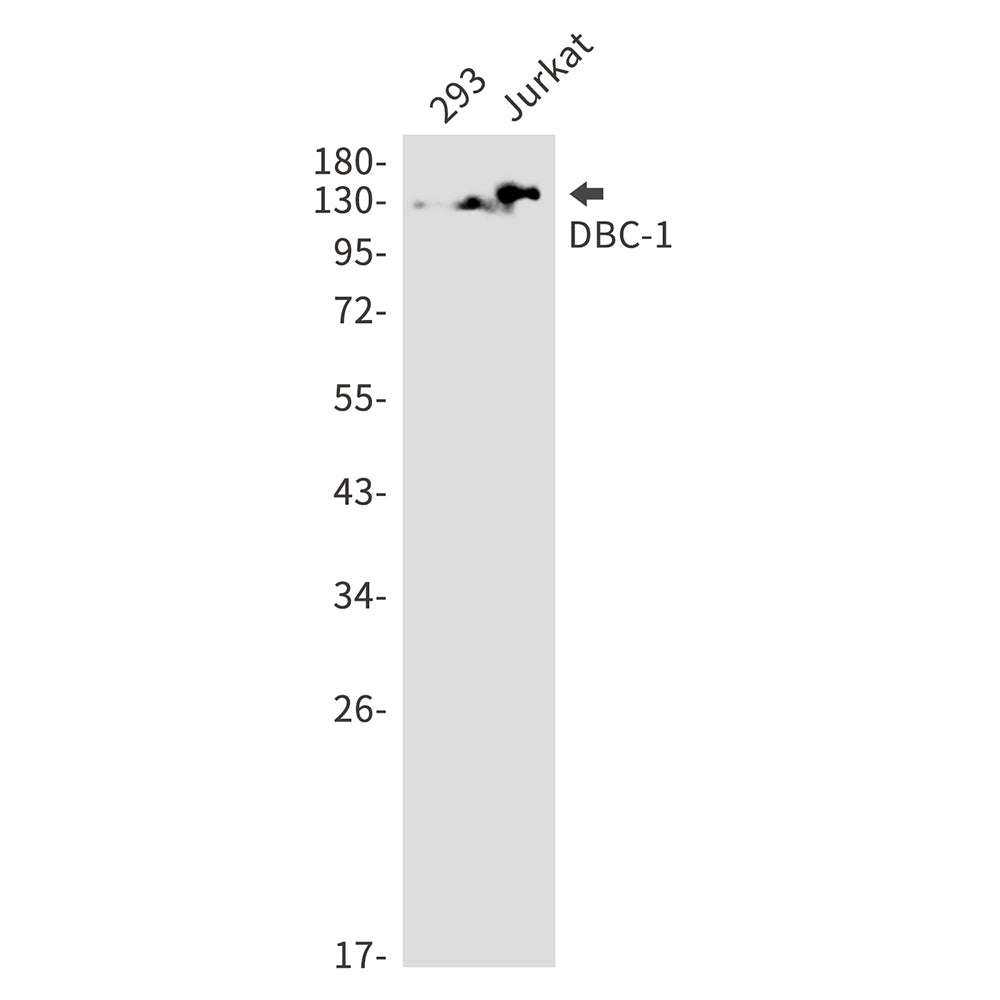 DBC 1 Rabbit Monoclonal Antibody
