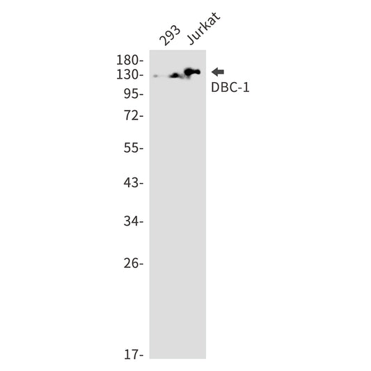 DBC 1 Rabbit Monoclonal Antibody