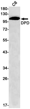 DPD Rabbit Monoclonal Antibody