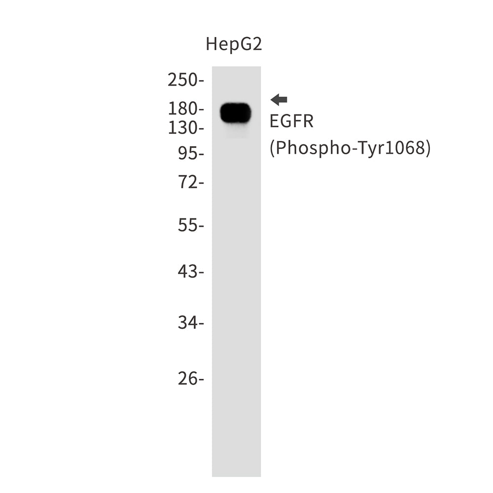 Phospho-EGFR (Tyr1068) Rabbit Monoclonal Antibody