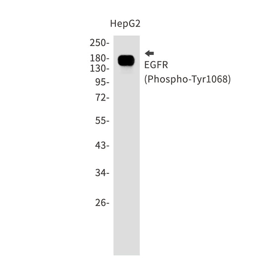 Phospho-EGFR (Tyr1068) Rabbit Monoclonal Antibody