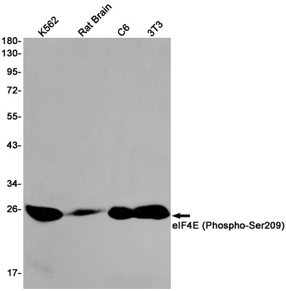 Phospho-eIF4E (Ser209) Rabbit Monoclonal Antibody