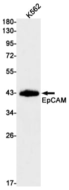 EpCAM Rabbit Monoclonal Antibody