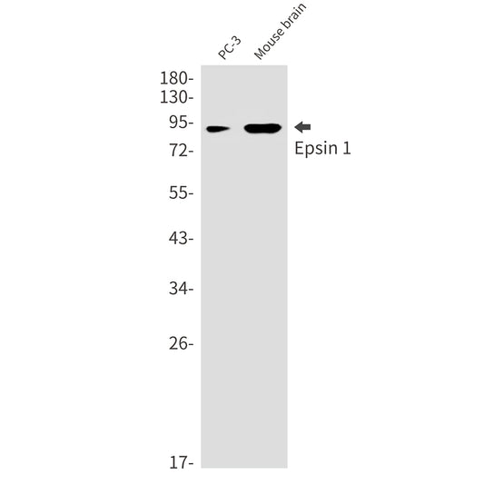 Epsin 1 Rabbit Monoclonal Antibody