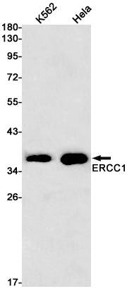 ERCC1 Rabbit Monoclonal Antibody