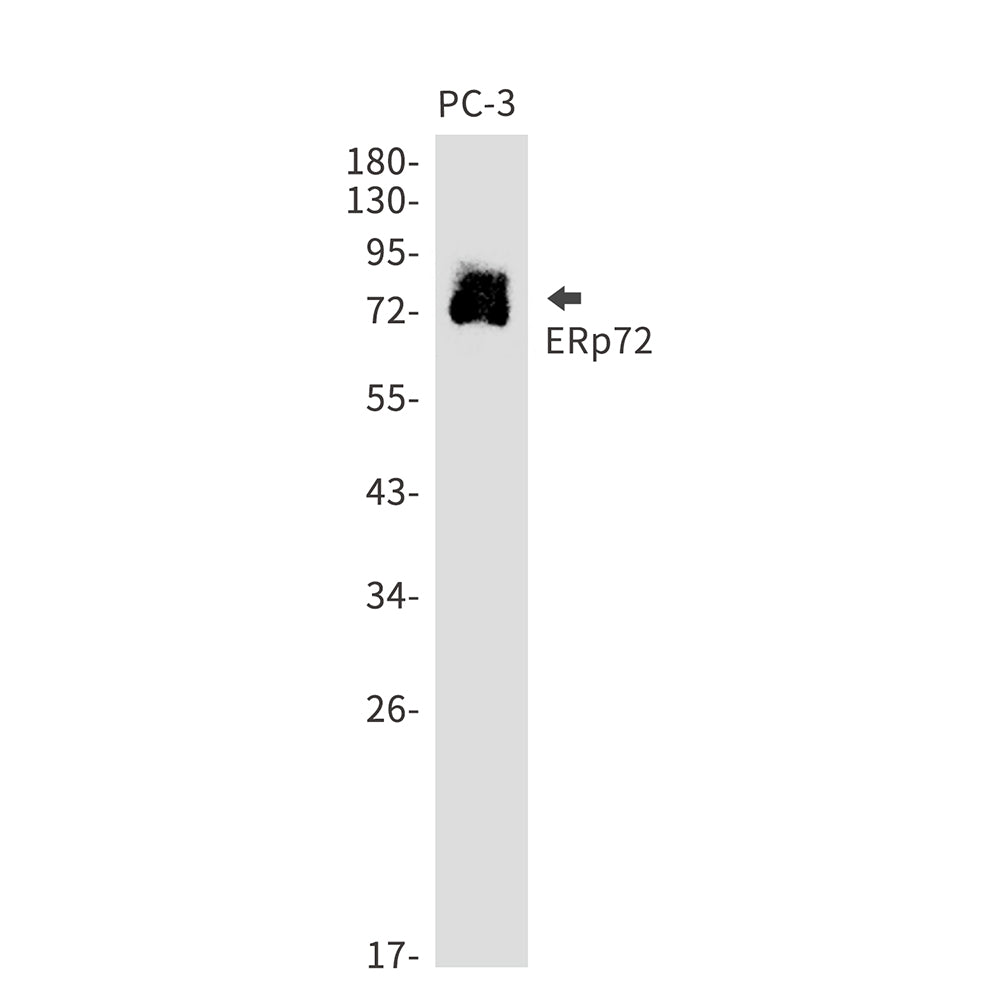 ERp72 Rabbit Monoclonal Antibody